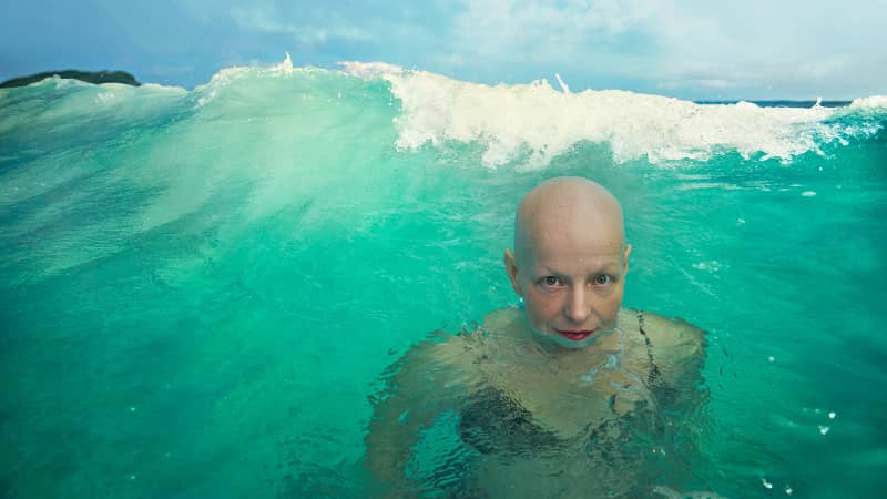 Rachel Fleit, a writer, director and advocate of people living with alopecia, is featured in the All-Inclusive Photo Project (AIPP) campaign from Celebrity Cruises.