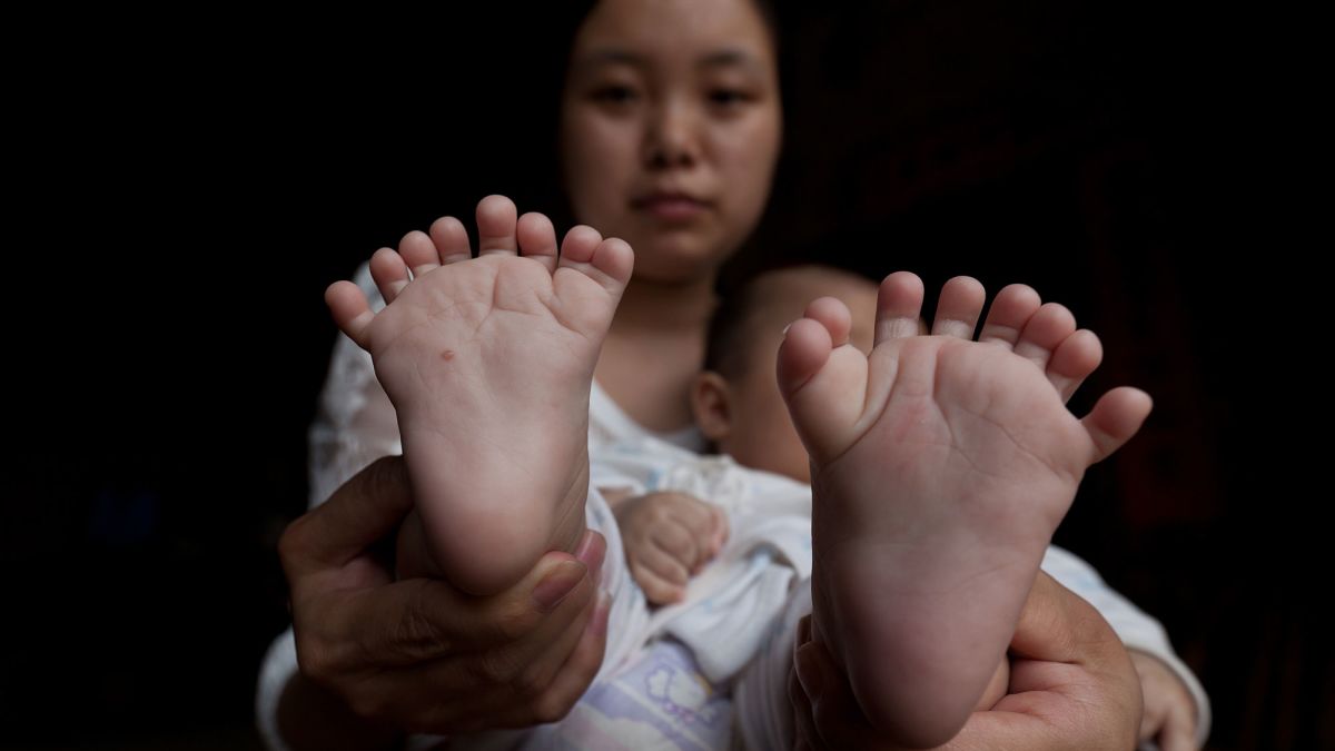 Chinese boy born with 31 fingers and toes | CNN