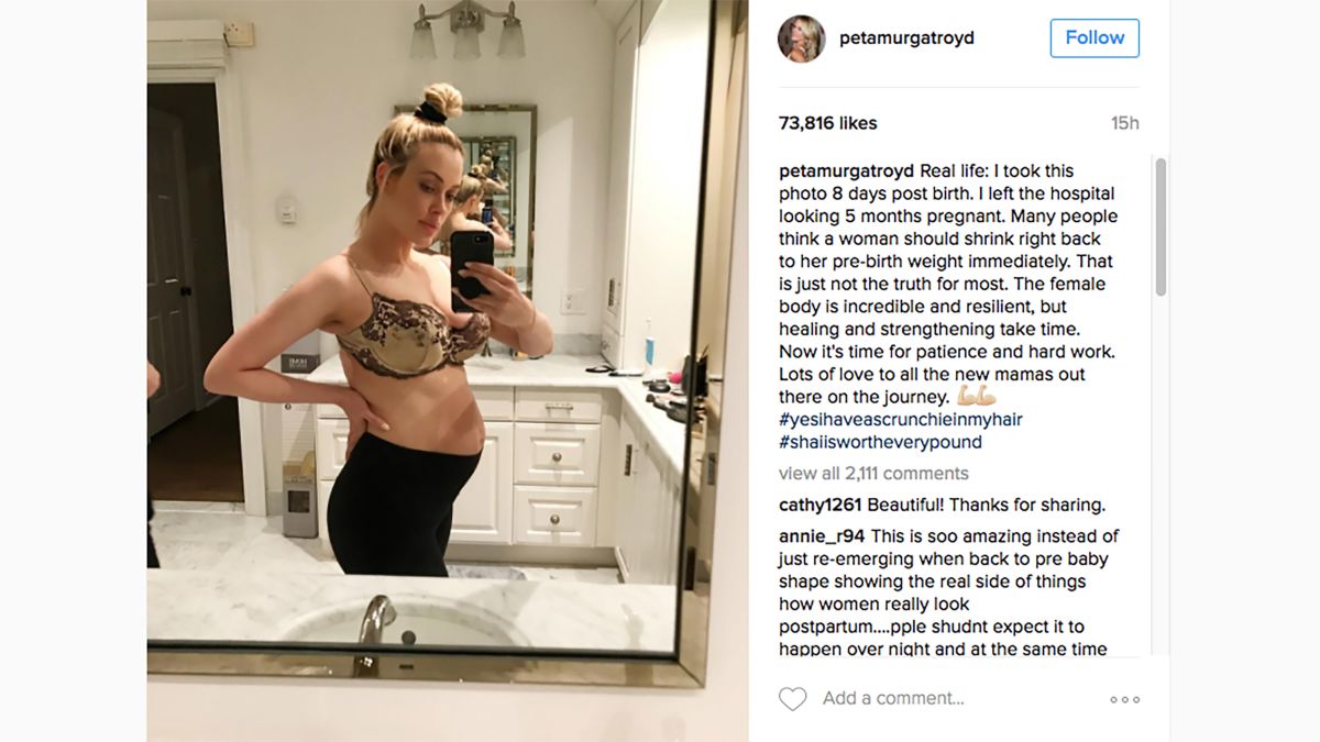 Peta Murgatroyd Talks Real Post Baby Body Cnn