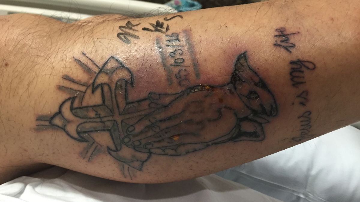 1 week old tattoo beach