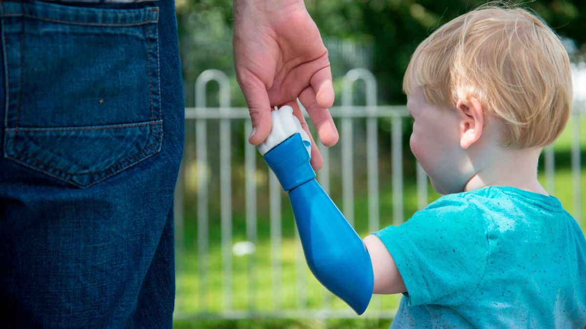 Dad Designs And 3d Prints A Prosthetic Arm For His Son Cnn,Residential Interior Design Contract Template