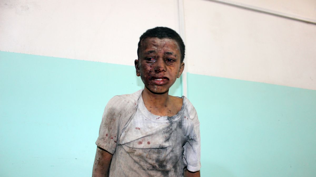 https%3A%2F%2Fcdn.cnn.com%2Fcnnnext%2Fdam%2Fassets%2F180810102214-12-yemen-schoolbus-airstrike-0809.jpg