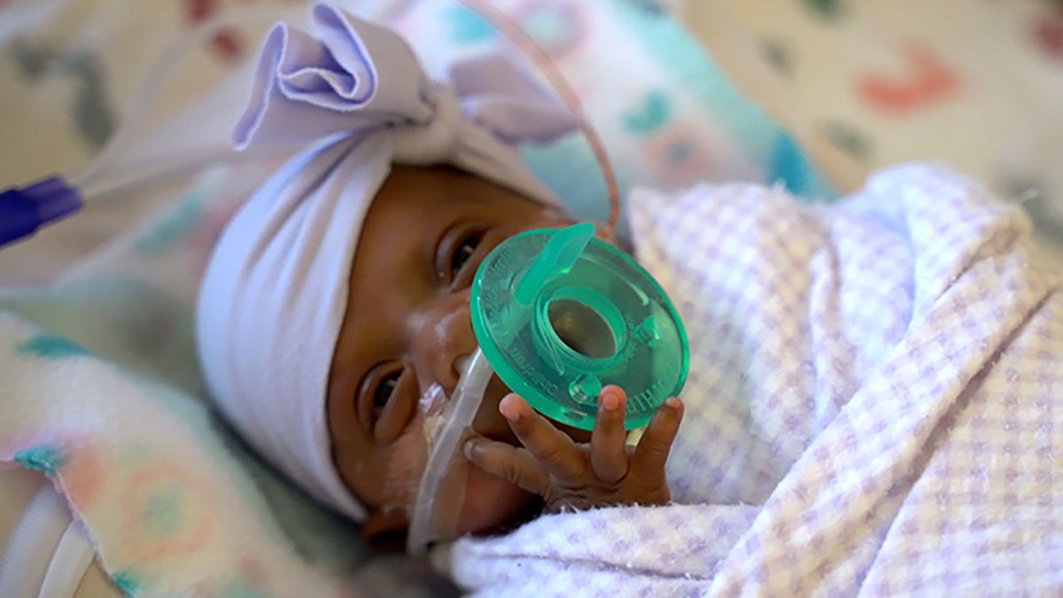 She was the world's smallest baby. Now she's a healthy infant