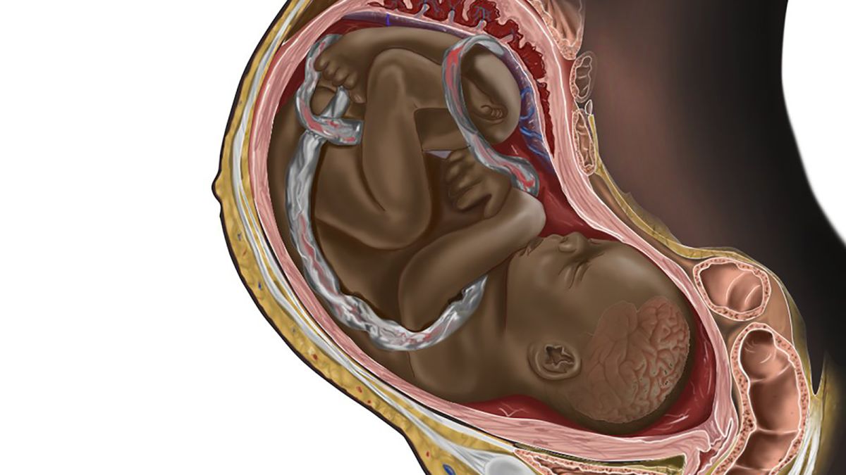 Medical College Girl Sexy Video - A viral image of a Black fetus is highlighting the need for diversity in  medical illustrations | CNN
