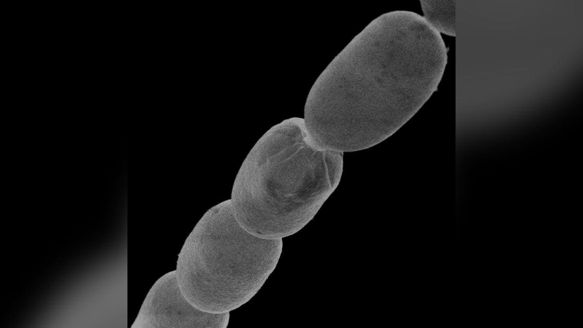 World's largest bacterium discovered is the size of a human eyelash | CNN