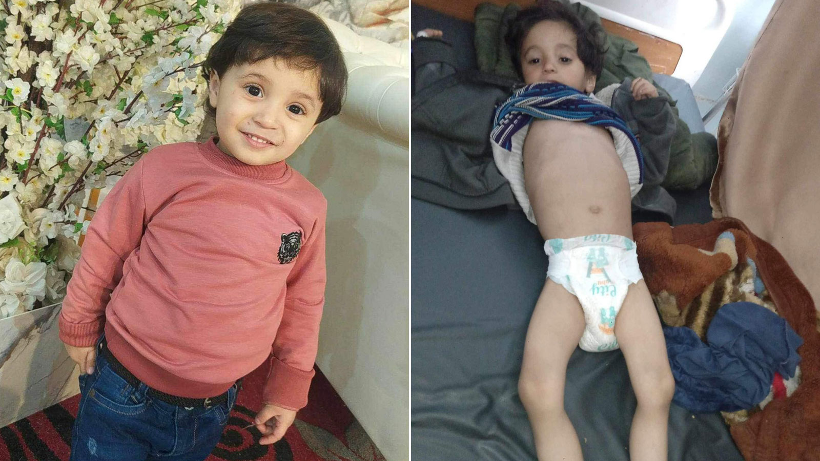 Left: Hassan is pictured in a Gaza City wedding hall in August 2023. Right: Hassan at the European Hospital in Khan Younis, Gaza, on March 12. 