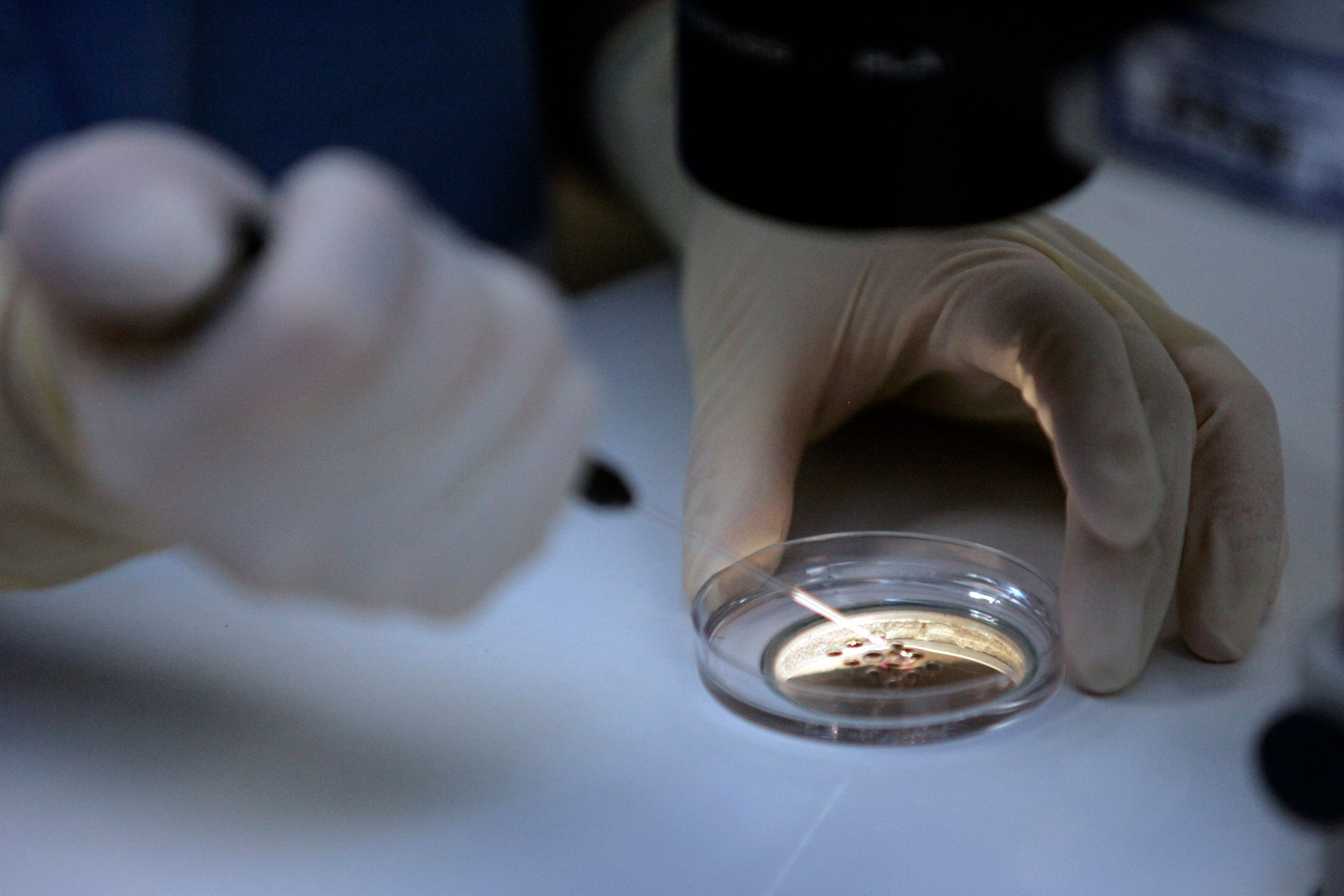 A doctor at the University of California San Francisco embryology lab works with embryos prior to fertilization. 