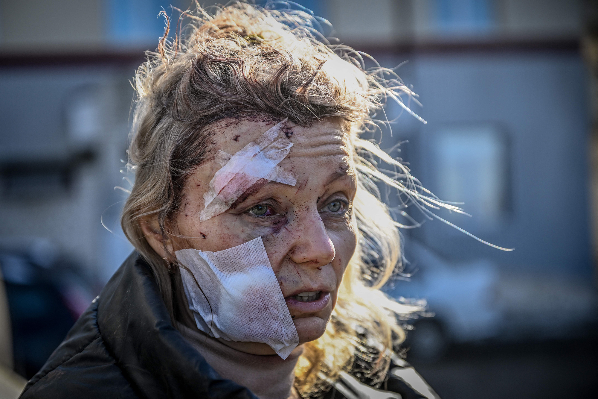 Olena Kurylo, a 52-year-old teacher, stands outside a hospital after the bombing of the eastern Ukraine town of Chuguiv on February 24.