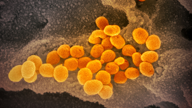 This scanning electron microscope image shows SARS-CoV-2 (orange)—also known as 2019-nCoV, the virus that causes COVID-19—isolated from a patient in the US, emerging from the surface of cells (gray) cultured in the lab. 