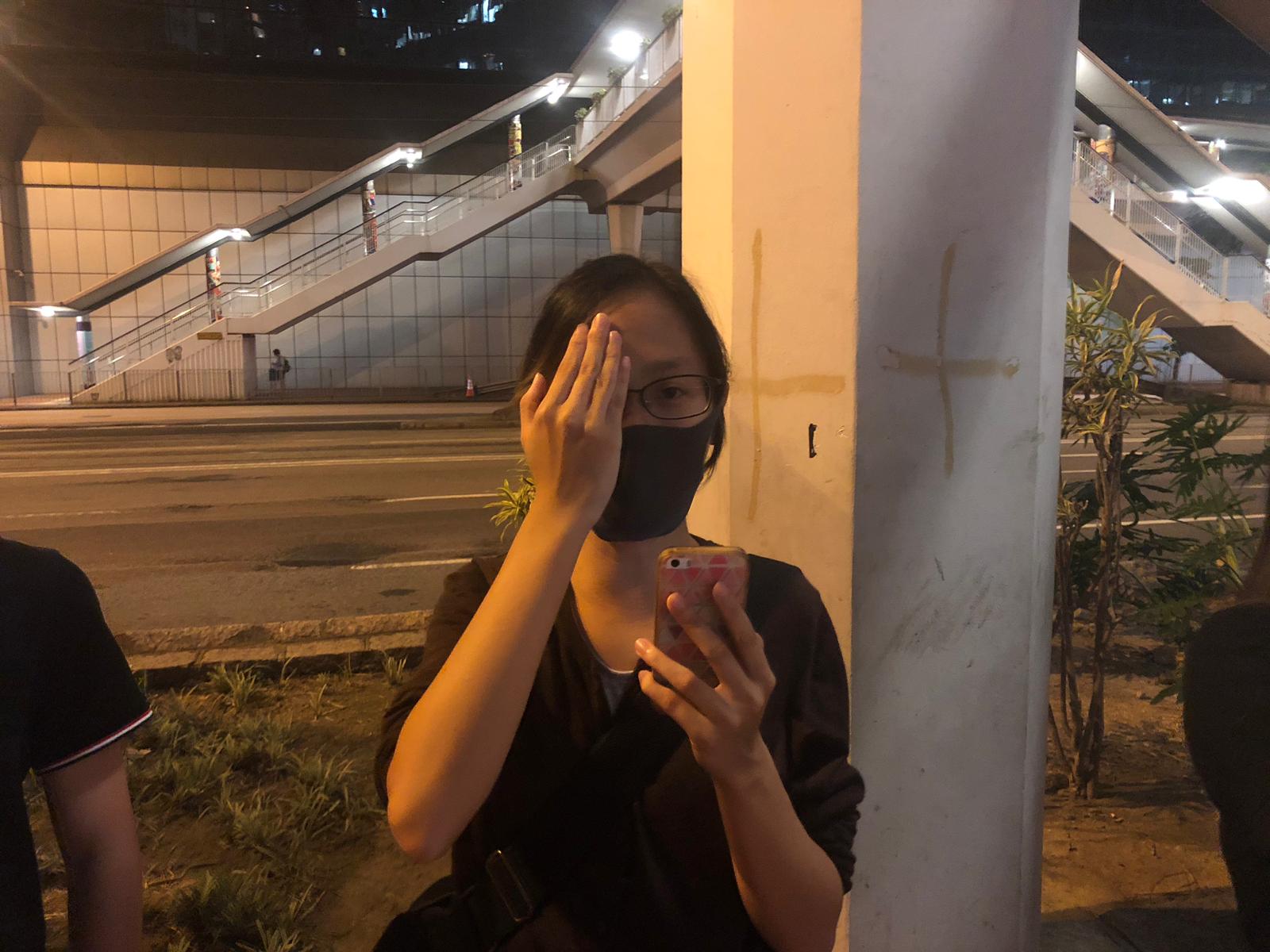 People are covering their eyes in solidarity with a woman who was injured during the protests. 