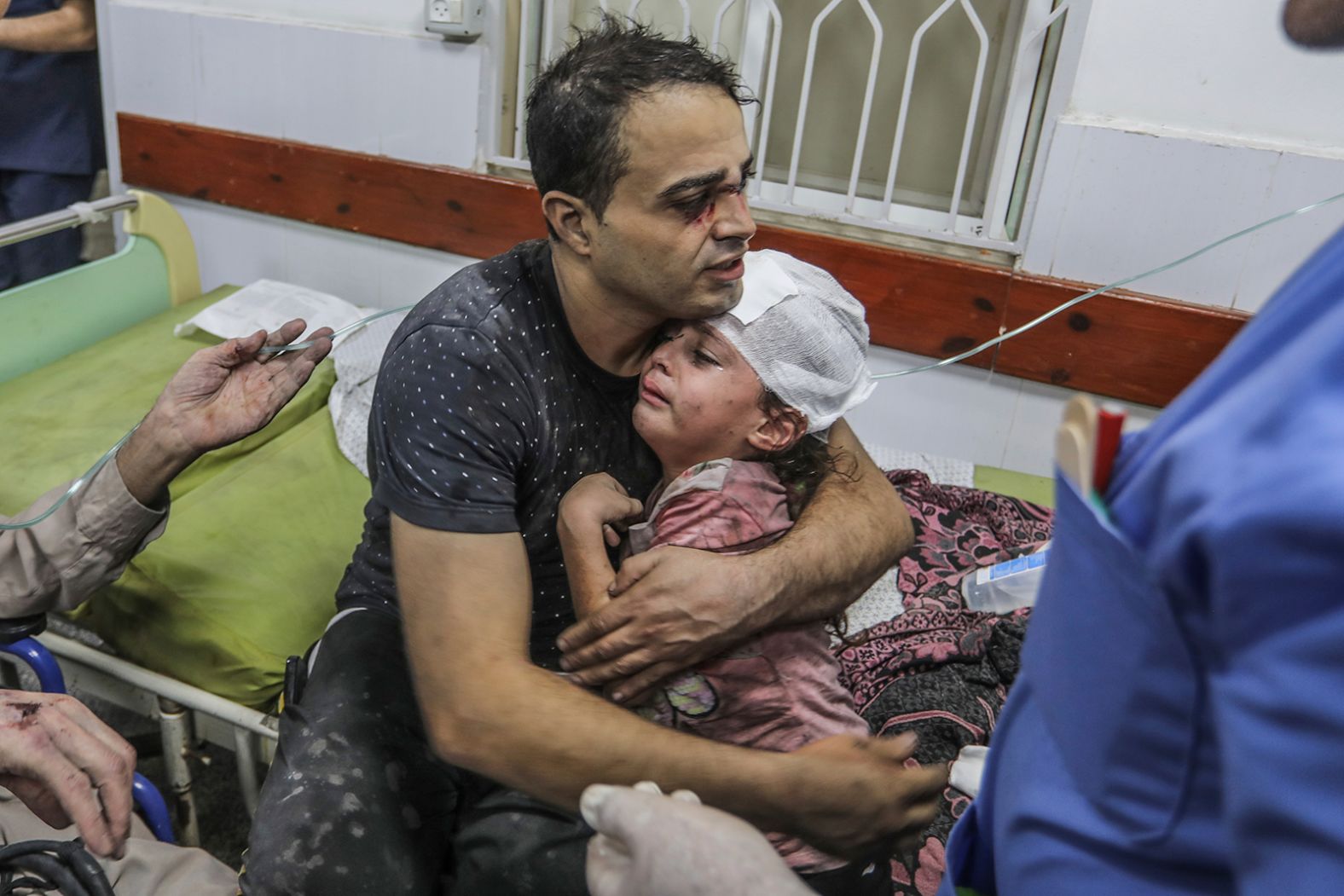 A Palestinian man holds his wounded child as they receive medical attention at Al-Najjar Hospital following an Israeli airstrike on Rafah in southern Gaza on October 30.