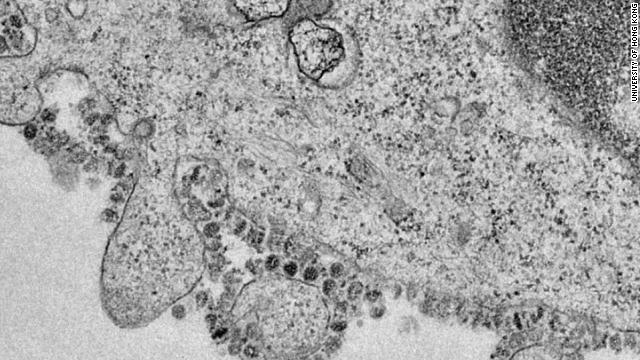Magnified images show coronavirus replicating