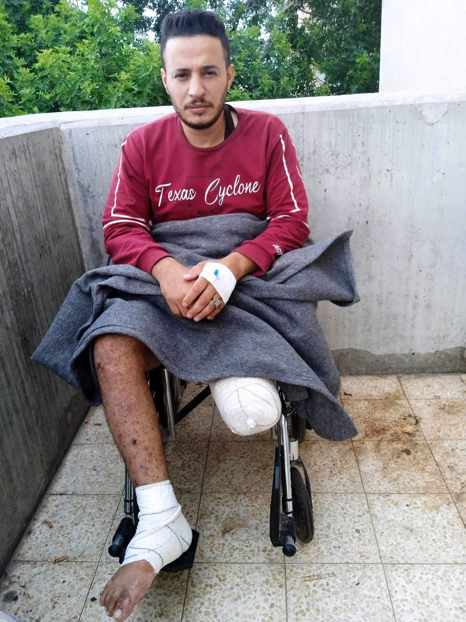 Muhammad Hassan Abu Watfa in Khan Younis, Gaza, last month. He was severely wounded by a strike while trying to buy bread in the Sheikh Radwan neighborhood, in northern Gaza, on October 16. His right foot was amputated twice.