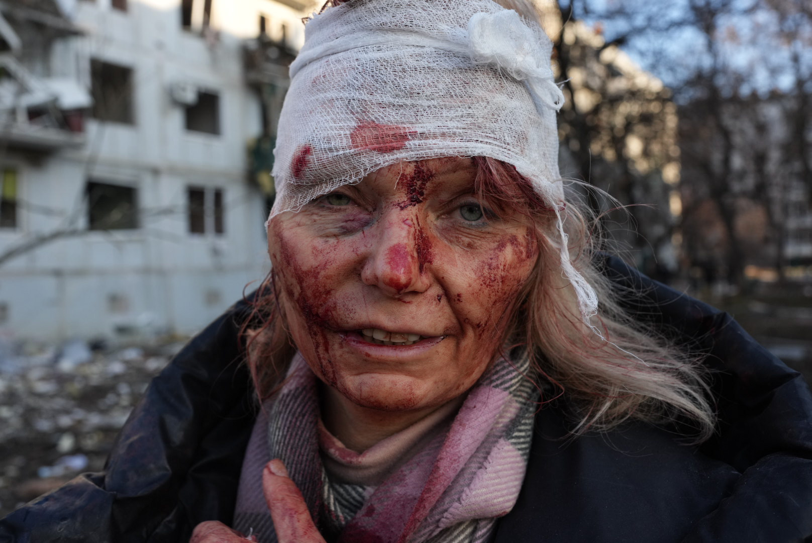 A wounded woman is seen after an airstrike damages an apartment complex outside of Kharkiv, Ukraine, on February 24.