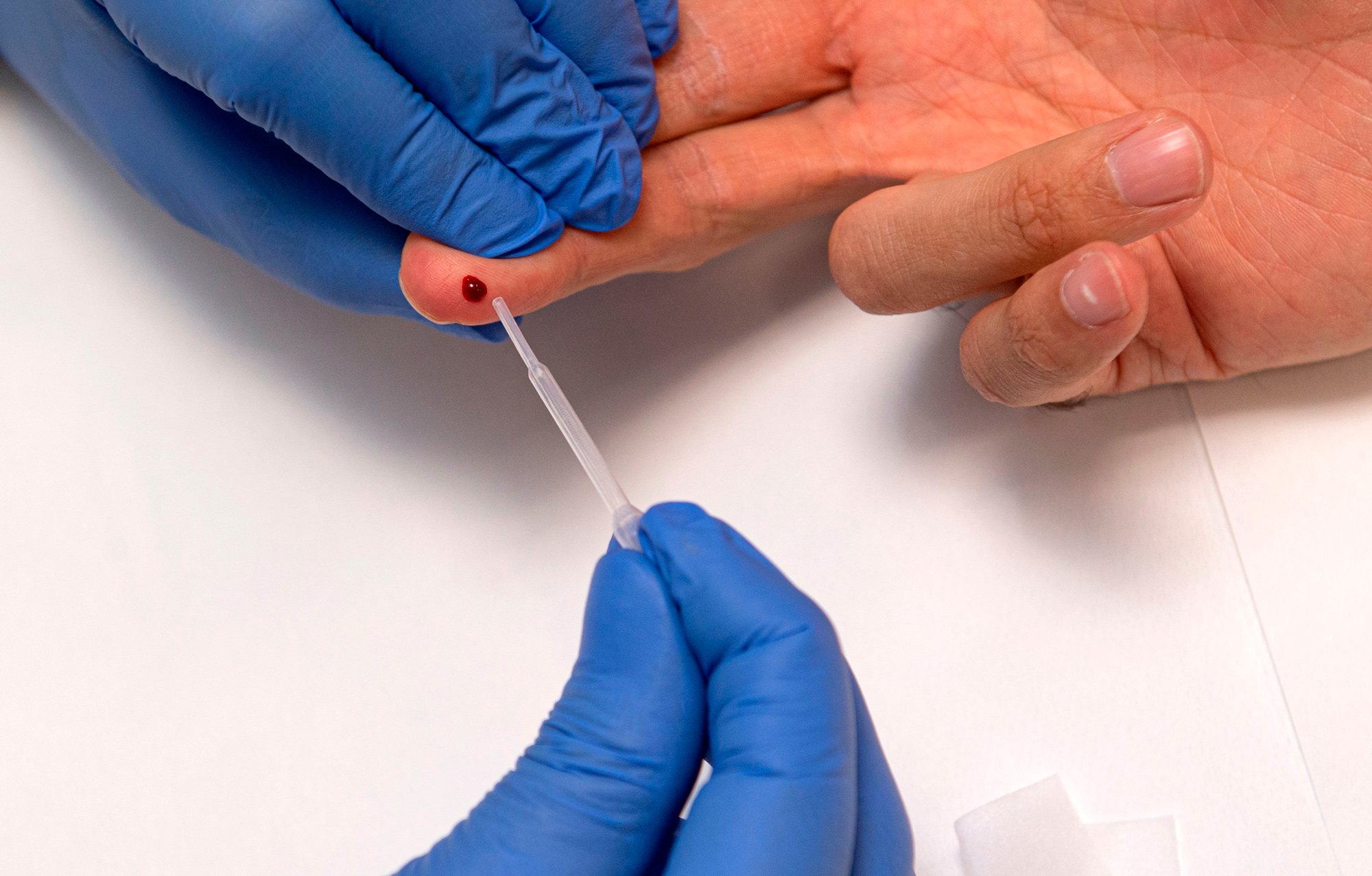 A person undergoes a finger prick blood sample as part of of an antibody rapid serological test for COVID-19 on May 6 at the Tor Vergata Covid hospital in Rome.