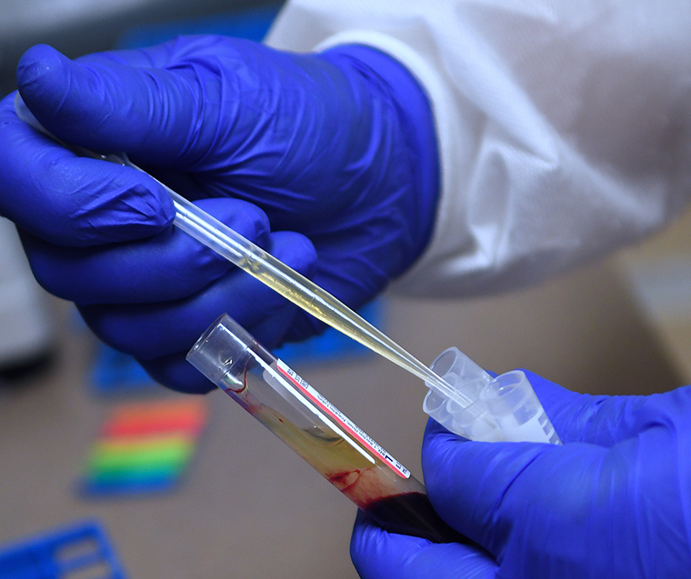 A blood sample is prepared for analysis by a laboratory technician at Accel Research Sites on August 4, in DeLand, Florida, during the Phase 3 COVID-19 vaccine clinical trial sponsored by Moderna.