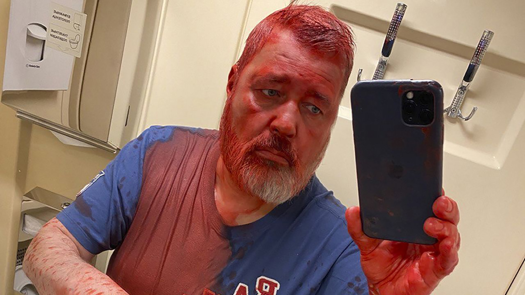 Nobel Peace Prize-winning newspaper editor Dmitry Muratov posted a selfie on Telegram after a reported attack on a Russian train. 