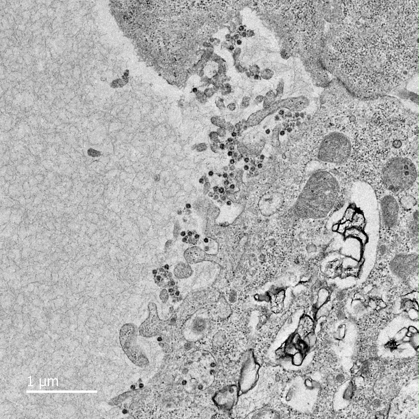 First confirmed case of coronavirus in Belgium