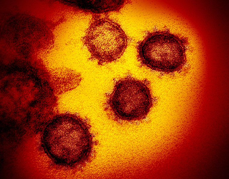 This transmission electron microscope image shows the virus that causes COVID-19. isolated from a patient in the U.S., emerging from the surface of cells cultured in the lab.