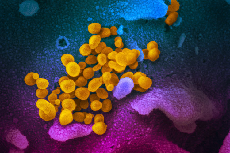 This image shows 2019-nCoV, the virus that causes Covid-19, isolated from a US patient.