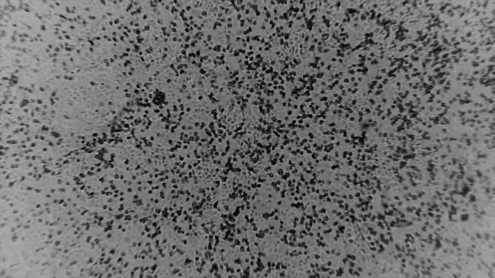 A screengrab from a video shows the novel coronavirus in microscopic view. Doherty Institute, University of Melbourne