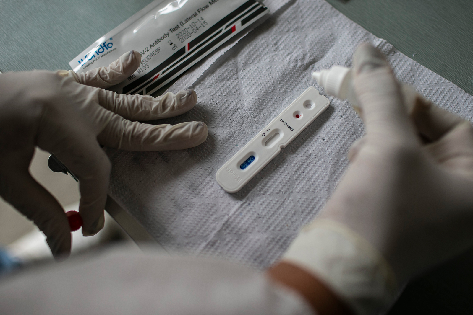 A coronavirus test kit at the Marques de Sapucai Sambadrome on June 15, in Rio de Janeiro, Brazil.