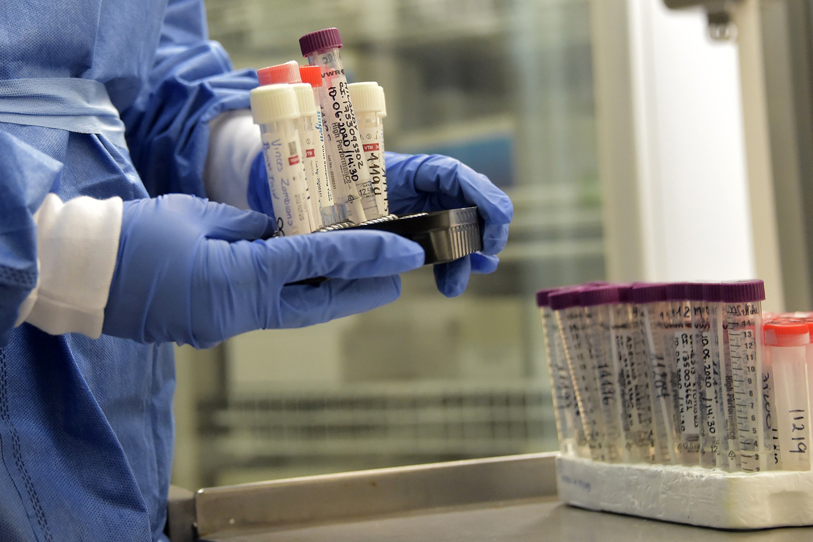 A medical workers holds test samples of suspected Covid-19 cases at the laboratory of the IESS Carlos Andrade Marin hospital in Quito, Ecuador on June 17.