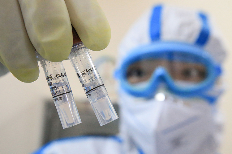 A laboratory technician holds up samples of the coronavirus at a laboratory in Hengyang in China's central Henan province on Wednesday, February 19.