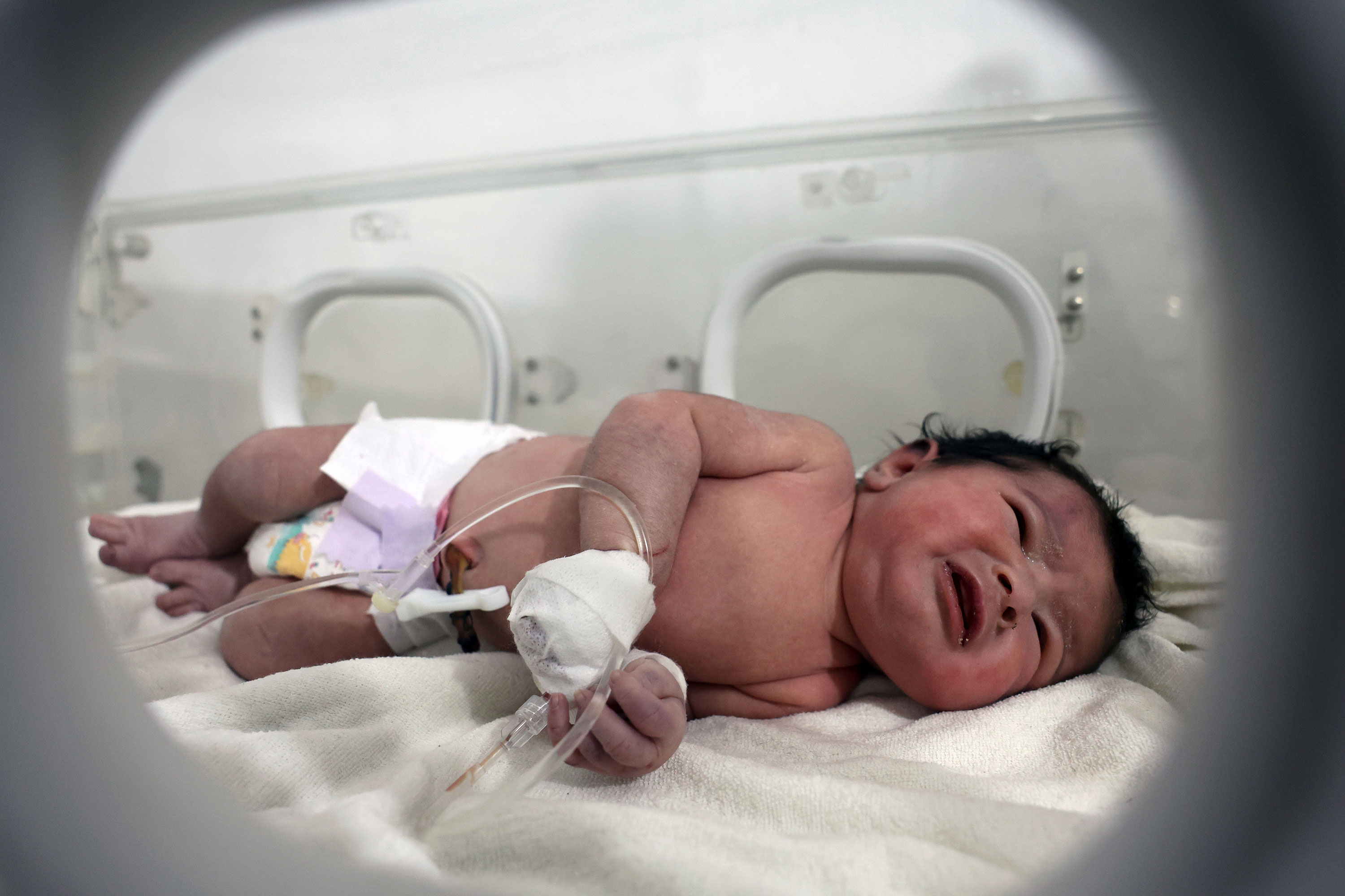 A baby girl who was rescued receives treatment inside an incubator at a hospital in Afrin, Syria, on Tuesday.