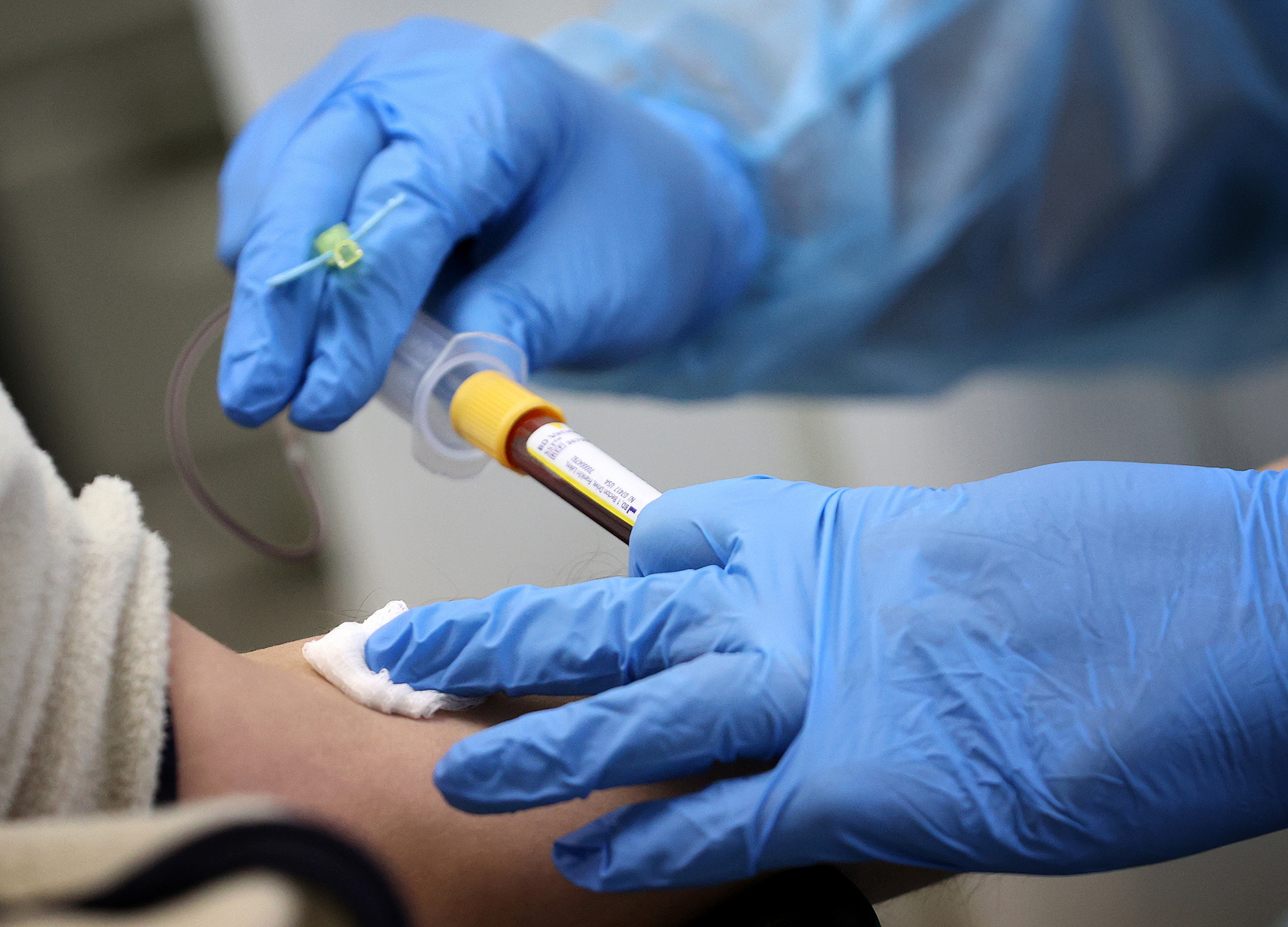 A resident has their blood drawn for an antibody test for the coronavirus - also called a serology test - on June 16, 2020 in Washington, DC. 