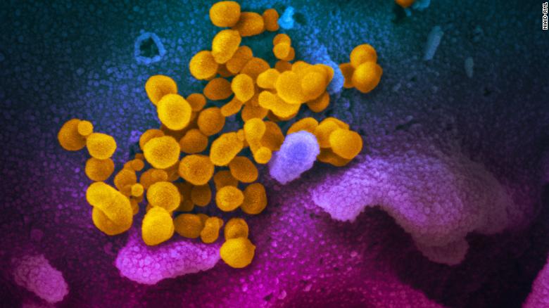 This scanning electron microscope image shows the SARS-CoV-2 virus (in yellow), which causes Covid-19. 