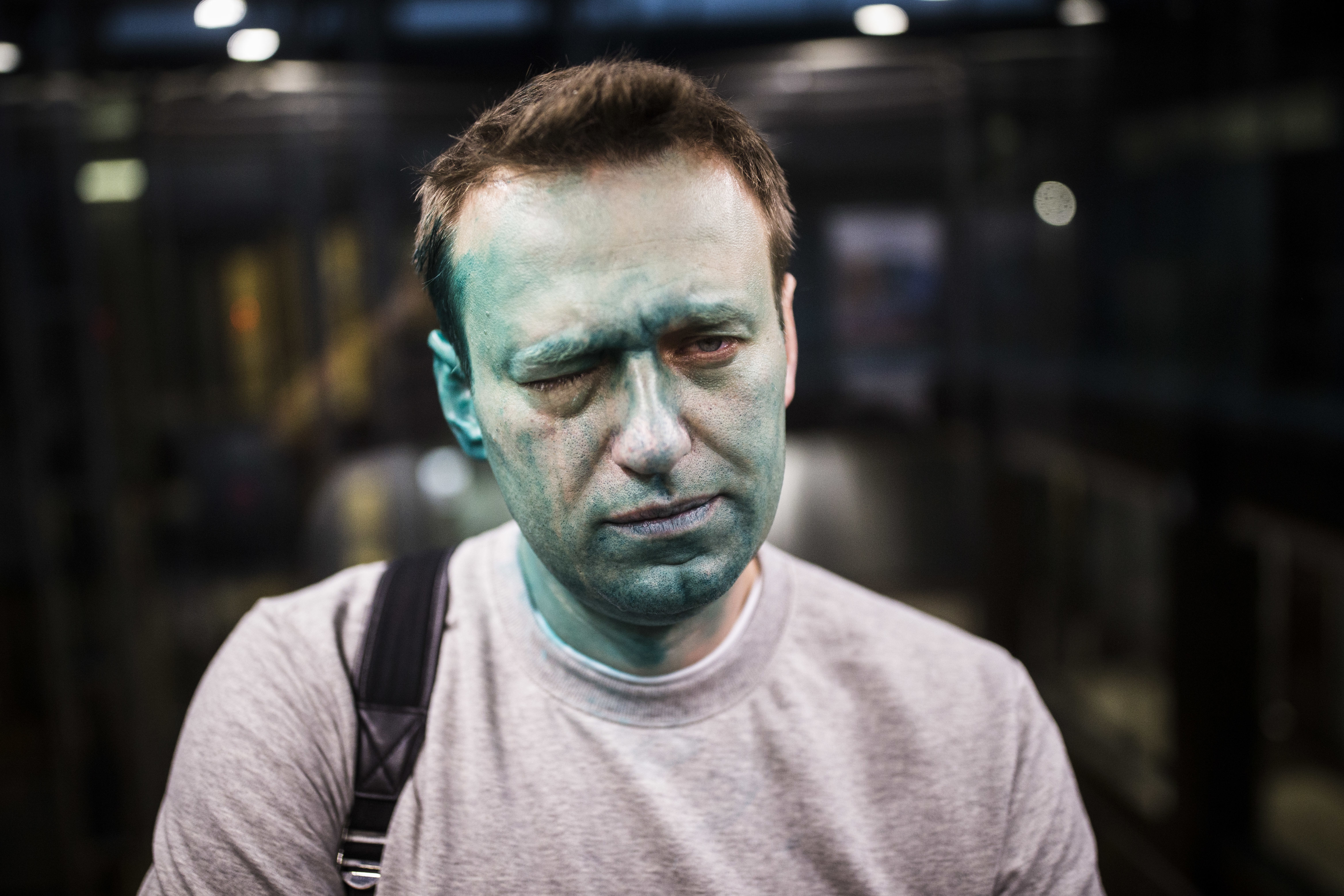Navalny poses for a photo after unknown attackers splashed him in the face with an antiseptic green dye in April 2017. The attack caused vision damage in one eye.