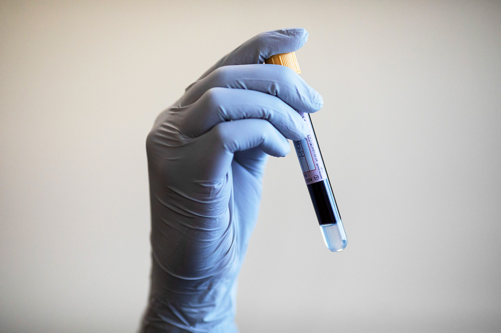 Paramedic Jess Baddams poses while holding a blood sample during an antibody testing programme at the Hollymore Ambulance Hub of the West Midlands Ambulance Service in Birmingham on June 5.