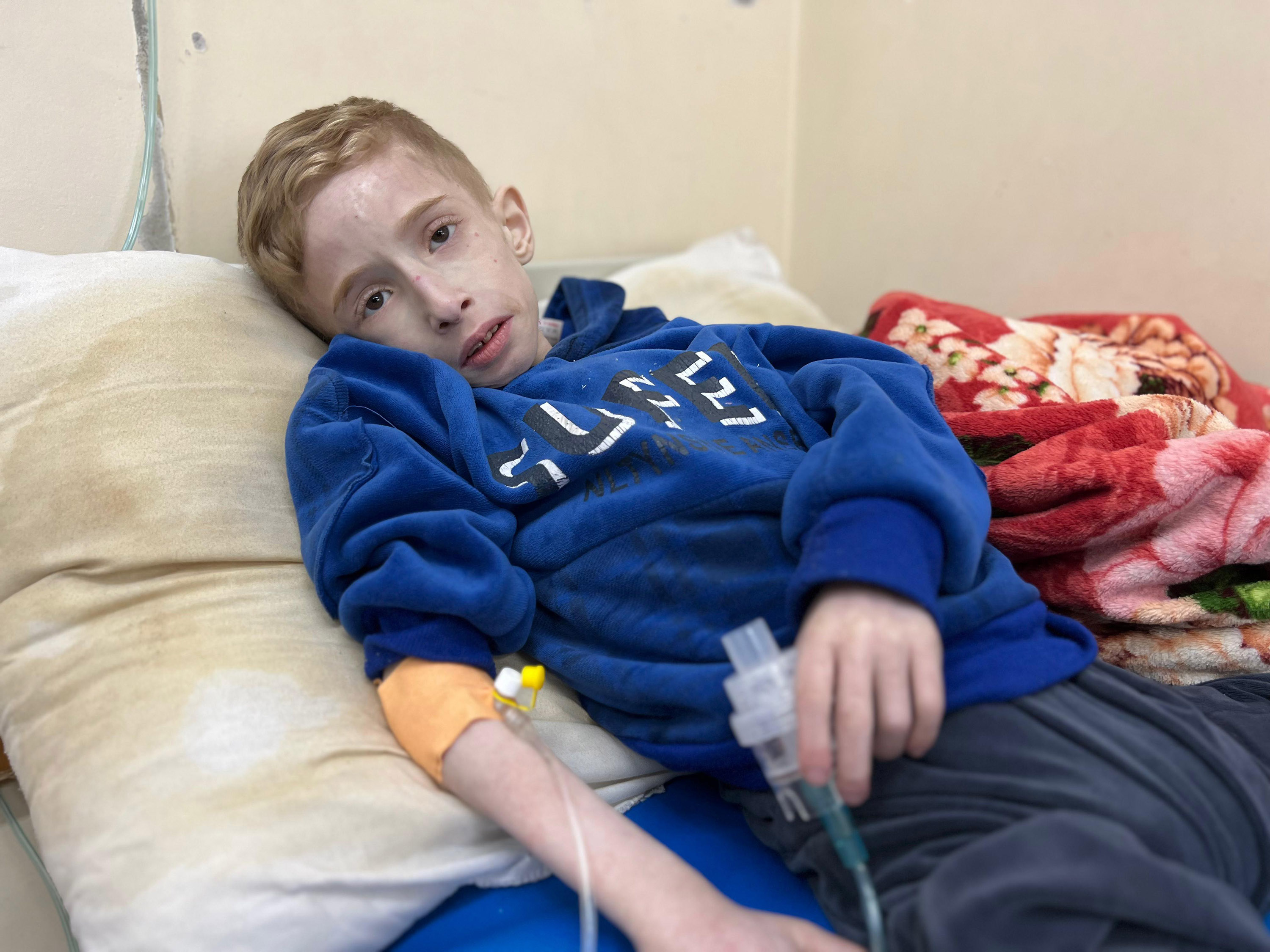 Six-year-old Fadi Al-Zanat is pictured on March 10 at Kamal Adwan Hospital in Beit Lahia, Gaza, where he is suffering from severe malnutrition and dehydration, according to the health ministry in the strip.