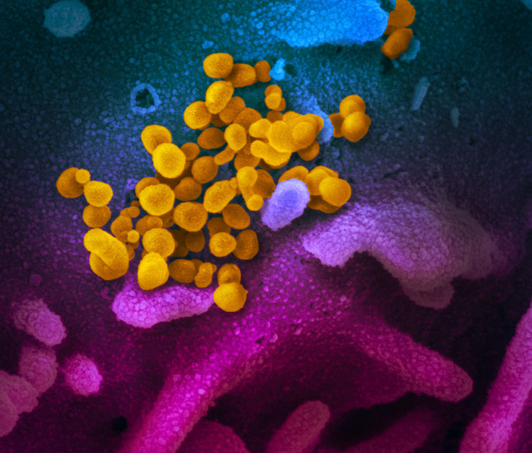 This scanning electron microscope image shows SARS-CoV-2 (yellow)—also known as 2019-nCoV, the virus that causes COVID-19—isolated from a patient in the US, emerging from the surface of cells (blue/pink) cultured in the lab. 