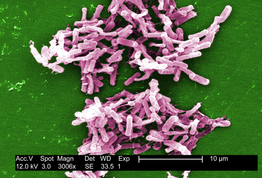 Clostridium difficile infections