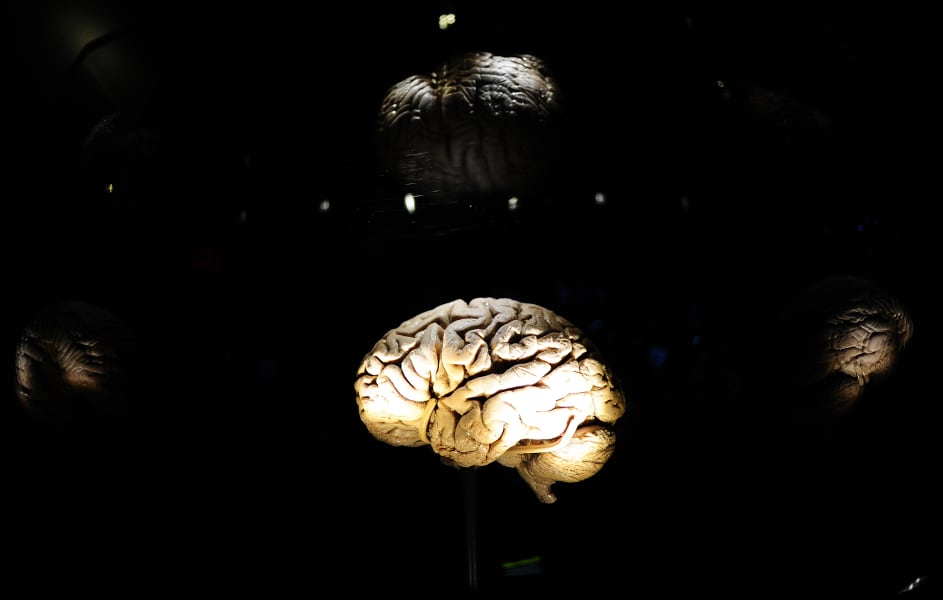 brain side view