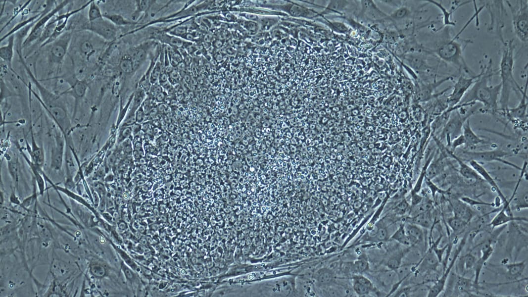 15 stem cells