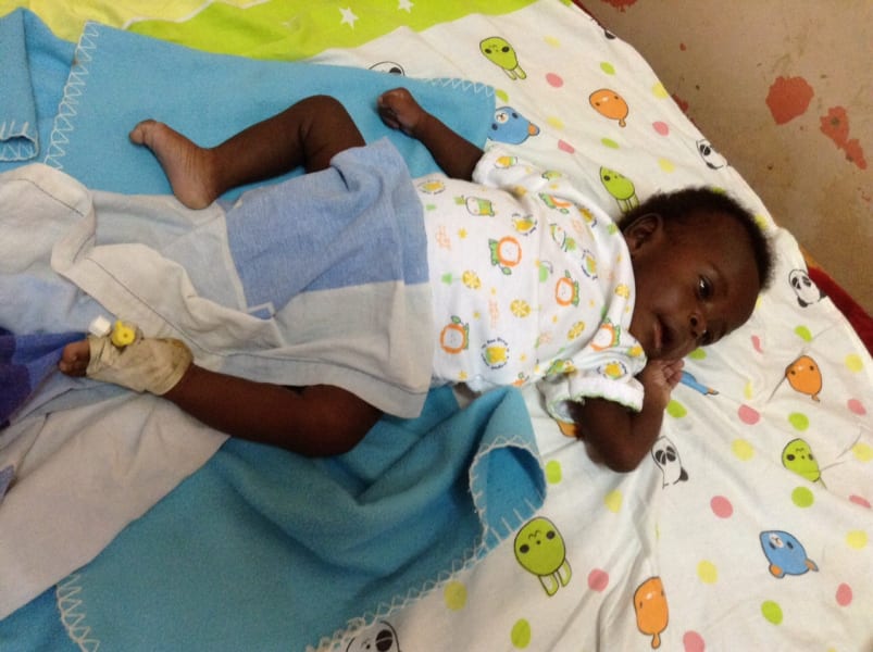 ugandan boy multiple limbs paul mukisa after surgery