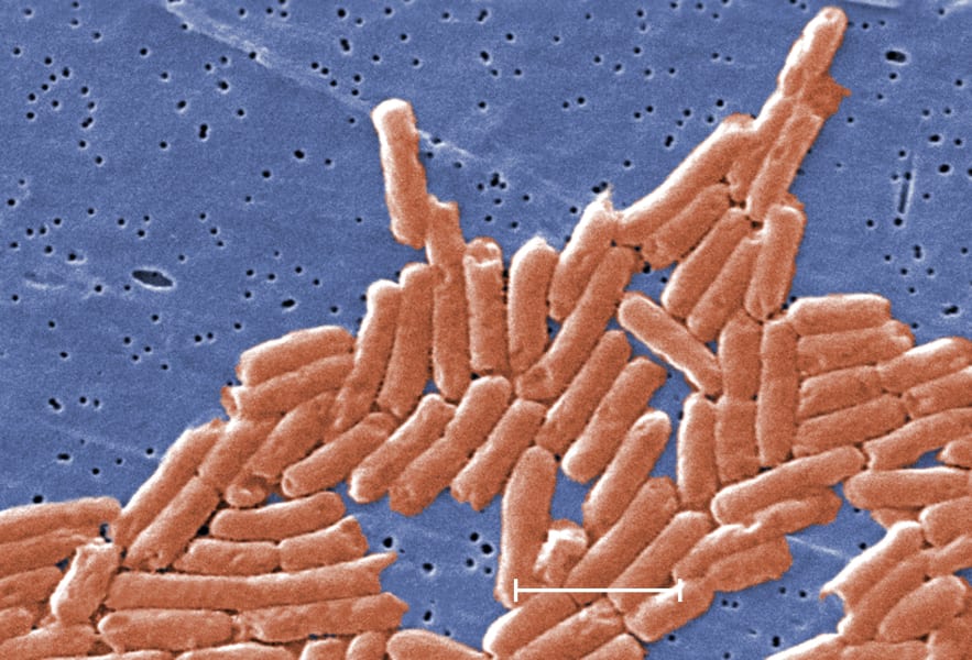 Salmonella enterica