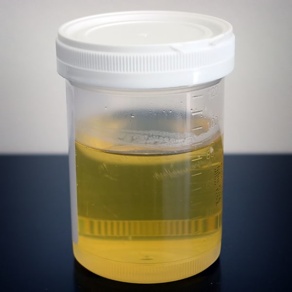 urine sample