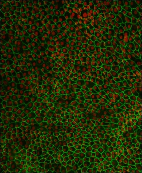 RPE embryo stem