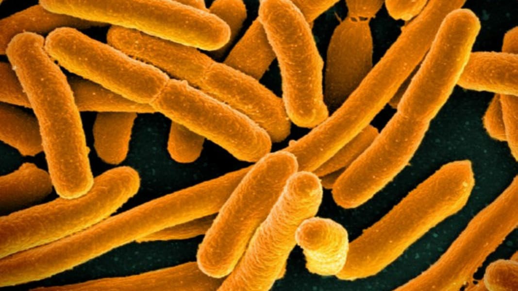 Enterobacter or E. coli