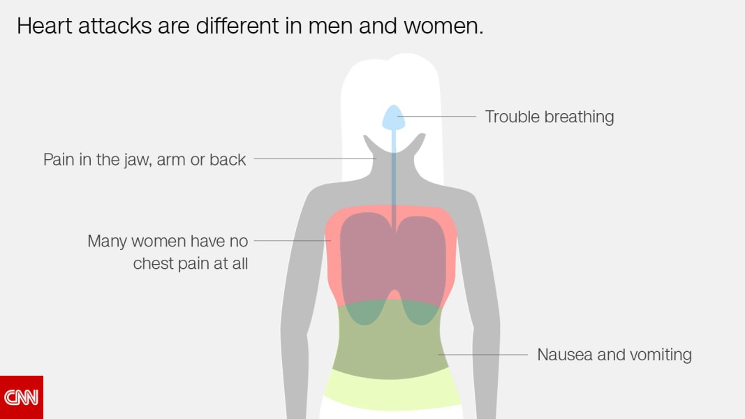 women heart attacks facts 01