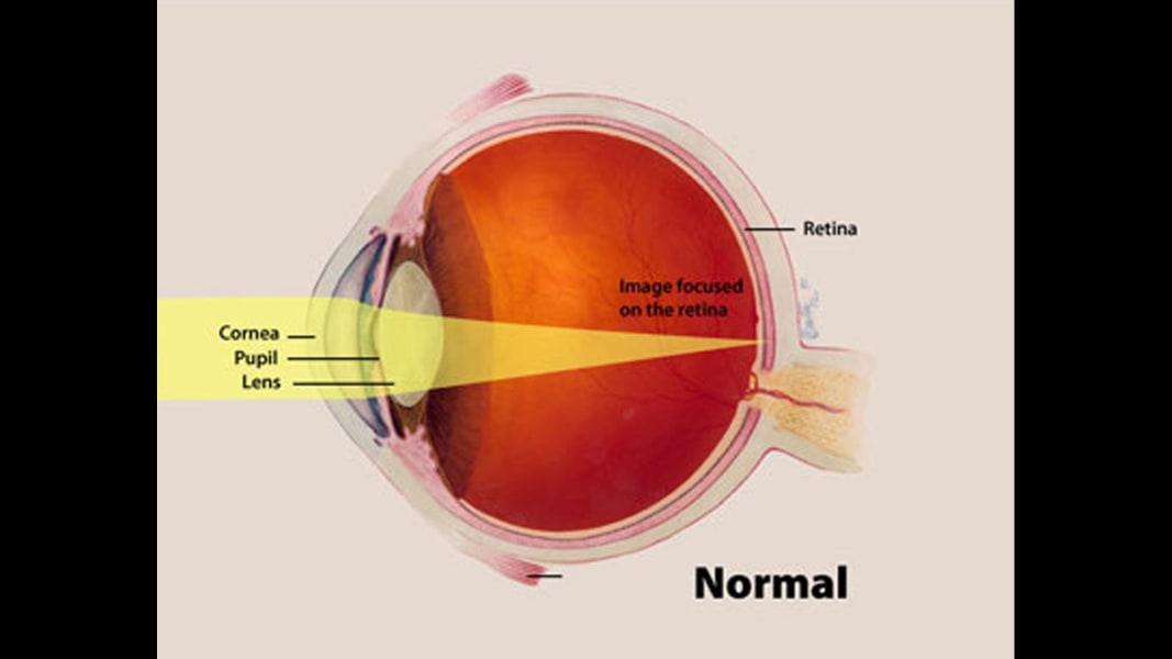 01 eye predicts health conditions normal eye