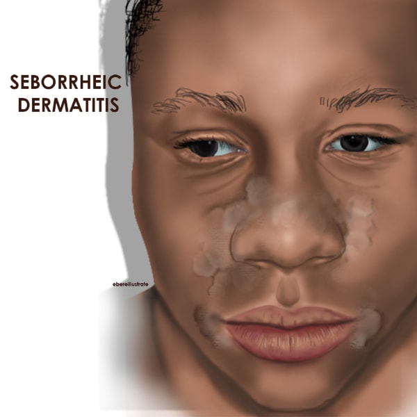 RESTRICTED Chidiebere medical illustration 7