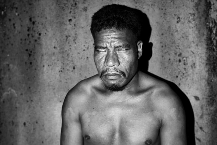 Eric, a colorblind inhabitant of Pingelap, poses for a portrait lit by flashlight. 