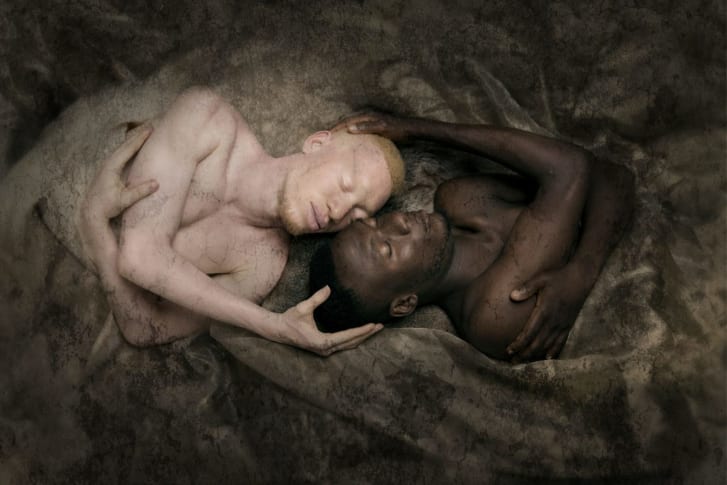 Taiwo Olateju (L) pictured with his twin brother, Kehinde who does not have albinism. 