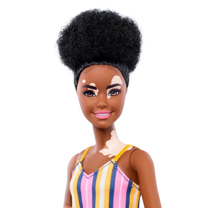 New Barbies feature vitiligo, hairless models in bid to boost diversity